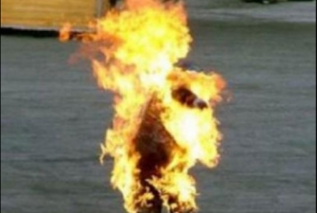  طالب إعدادي يضرم النيران في زميله بالزقازيق