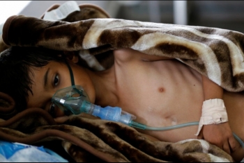  رقم كارثي لضحايا الكوليرا في اليمن