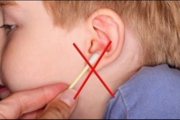  دراسة تحذر.. الأعواد القطنية تثقب طبلة الأذن
