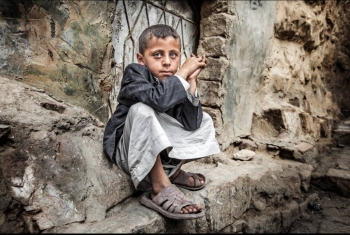  1000 طفل يمني في انتظار العلاج من الإسهال المائي الحاد يوميًا