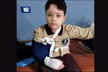  إصابة طالب بكسر مضاعف في معهد أبوحماد الأزهري أثناء اليوم الدراسي