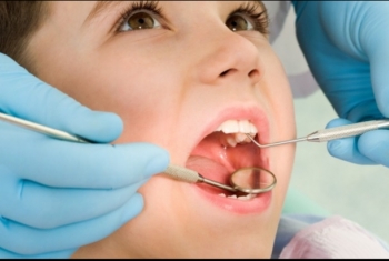  الأسبرين يعيد إصلاح تسوس الأسنان وترميمها دون الحاجة للحشو