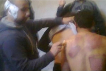  6 منظمات حقوقية: التعذيب في مصر منهج ثابت للانقلاب