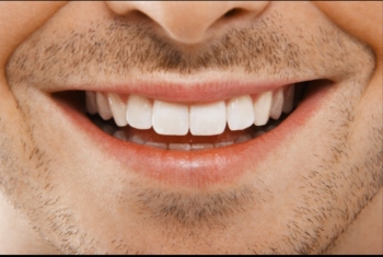  طرق بسيطة للمحافظة على صحة أسنانك من الالتهابات والتسوس