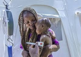  يونسيف: 1.4 مليون طفل معرضون لخطر سوء التغذية في الصومال