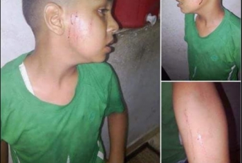  داخلية الانقلاب تعتقل طفل وتعذبه لإجبار والده على تسليم نفسه بفاقوس