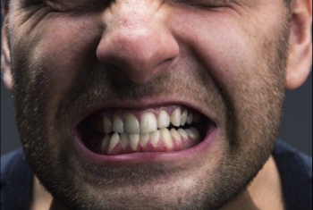  التوتر والاجهاد؟ مخاطر تهدد الأسنان