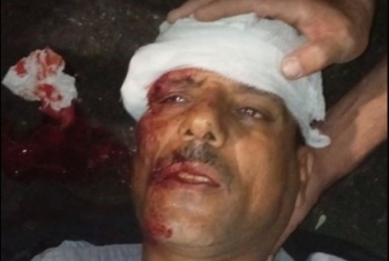  إصابة مواطن بإصابات خطيرة في حادث بالعاشر من رمضان