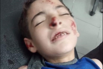  إصابة طفل في حادث مروري بالعاشر من رمضان