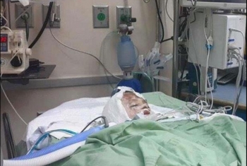  دولة الفوضى.. إصابة طالب فى مشاجرة مع زملائه بالمدرسة بمنيا القمح