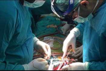  فريق طبي يستخرج 27 ملعقة وشوكة من أمعاء شاب بالدقهلية