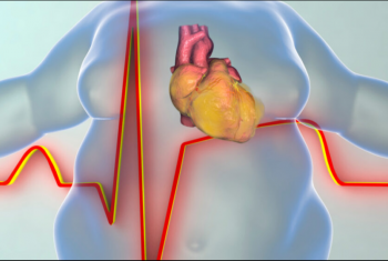  الصحة العالمية: مصر بين الدول الأعلى بوفيات أمراض القلب الناجمة عن الدهون